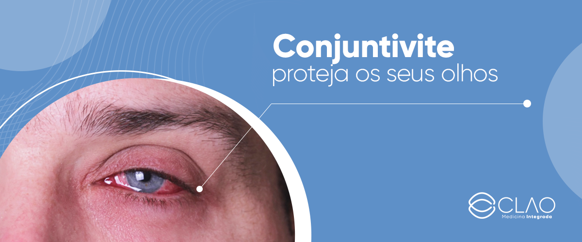 Conjuntivite proteja os seus olhos CLAO Medicina Integrada