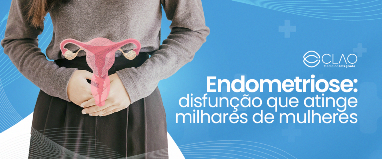 Endometriose: disfunção que atinge milhares de mulheres